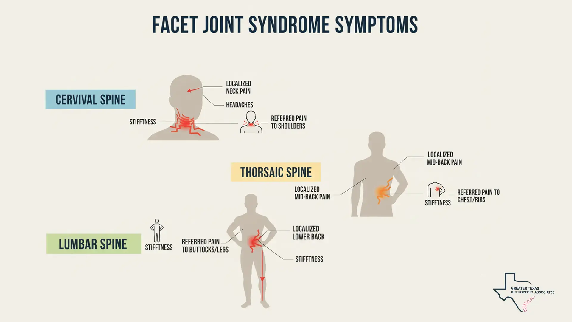 Facet Syndrome Symptoms and Their Locations
