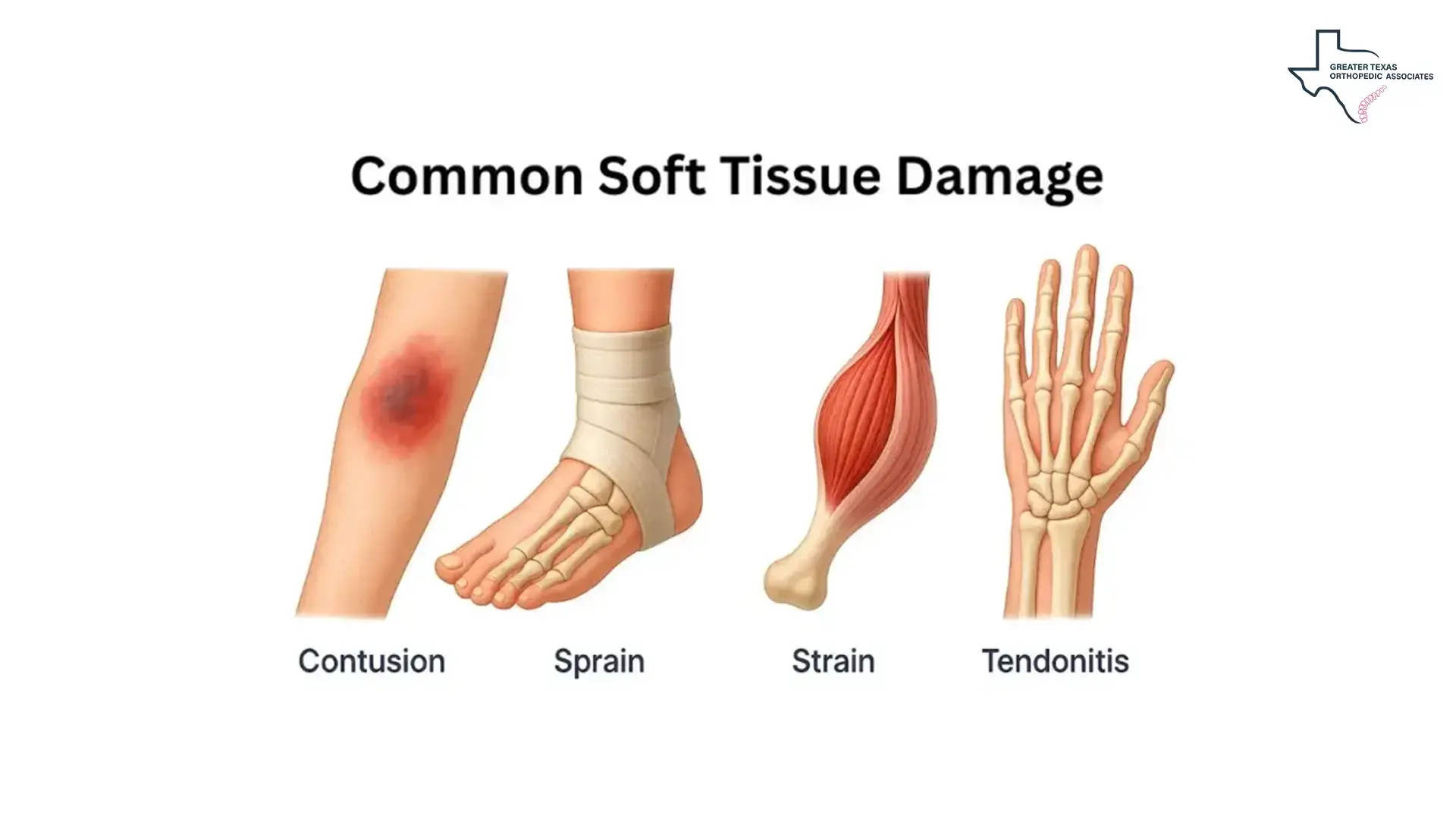 Common Soft Tissue Damage
