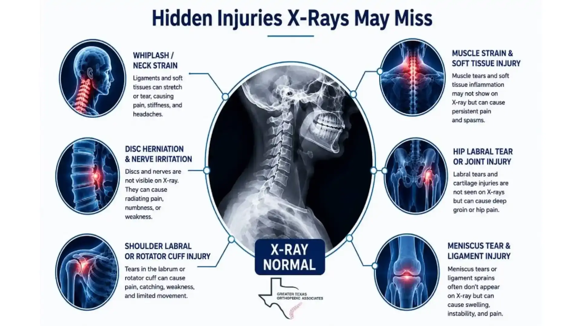 Hidden Injuries X-Rays May Miss