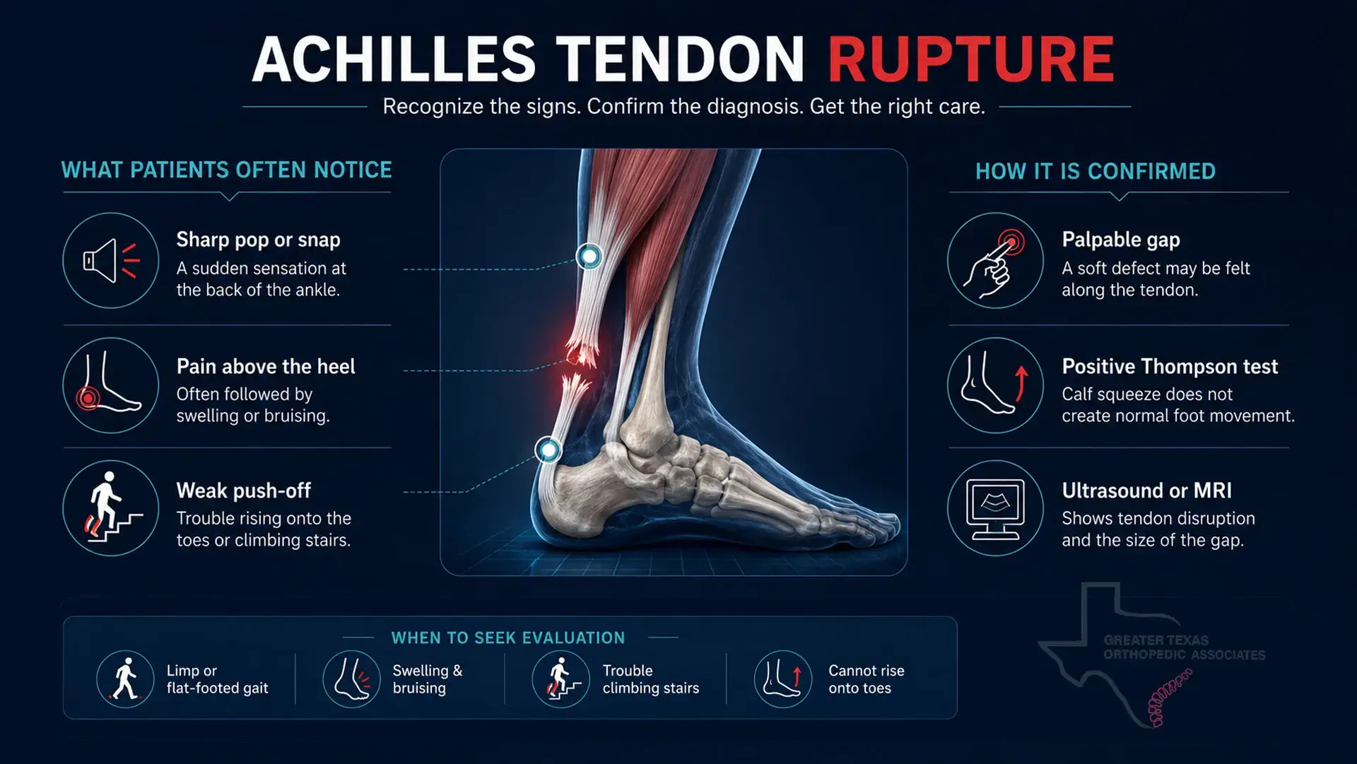 Infographic showing Achilles tendon rupture symptoms, Thompson test, imaging, and signs that need evaluation