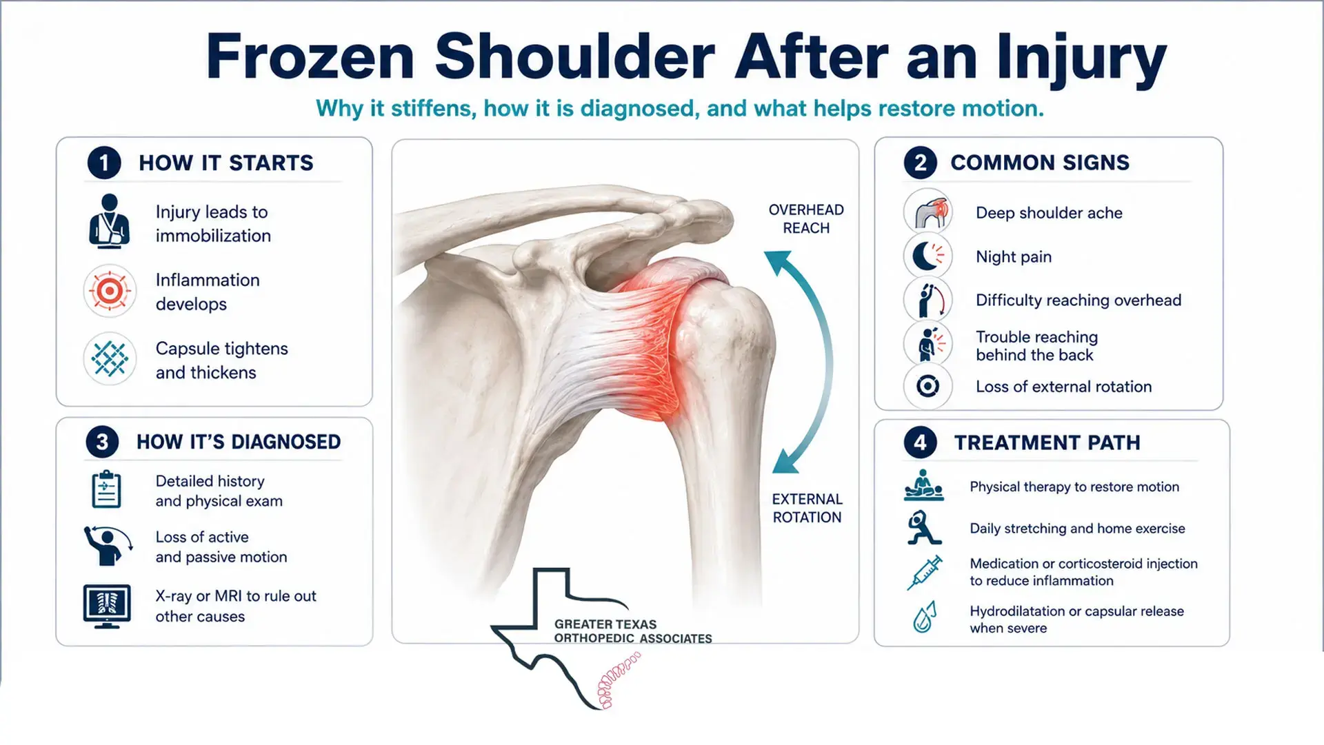 Infographic showing frozen shoulder after injury symptoms, diagnosis, limited shoulder motion, and treatment options
