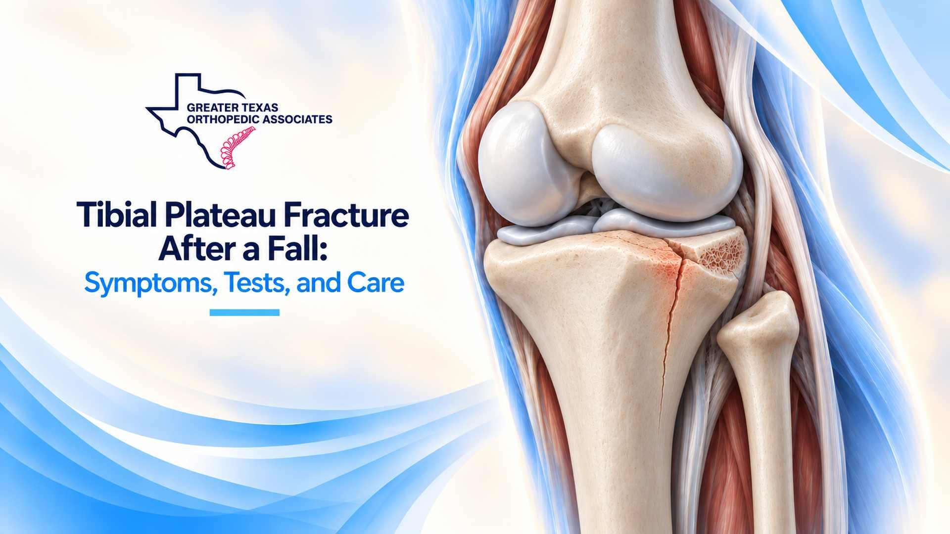 illustration of a tibial plateau fracture at the top of the shinbone