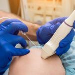 Radiofrequency Ablation (RFA) with GTOA