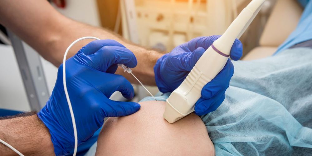 Radiofrequency Ablation (RFA) with GTOA