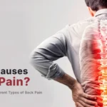 Causes of Back Pain