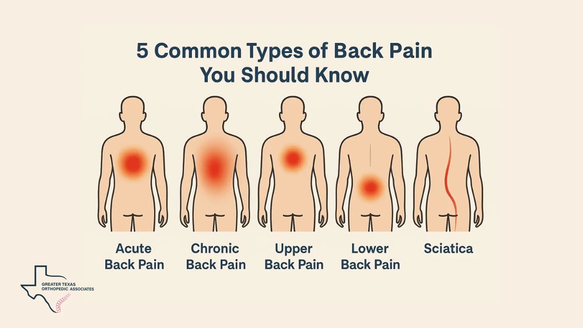 Classifying the Types of Back Pain