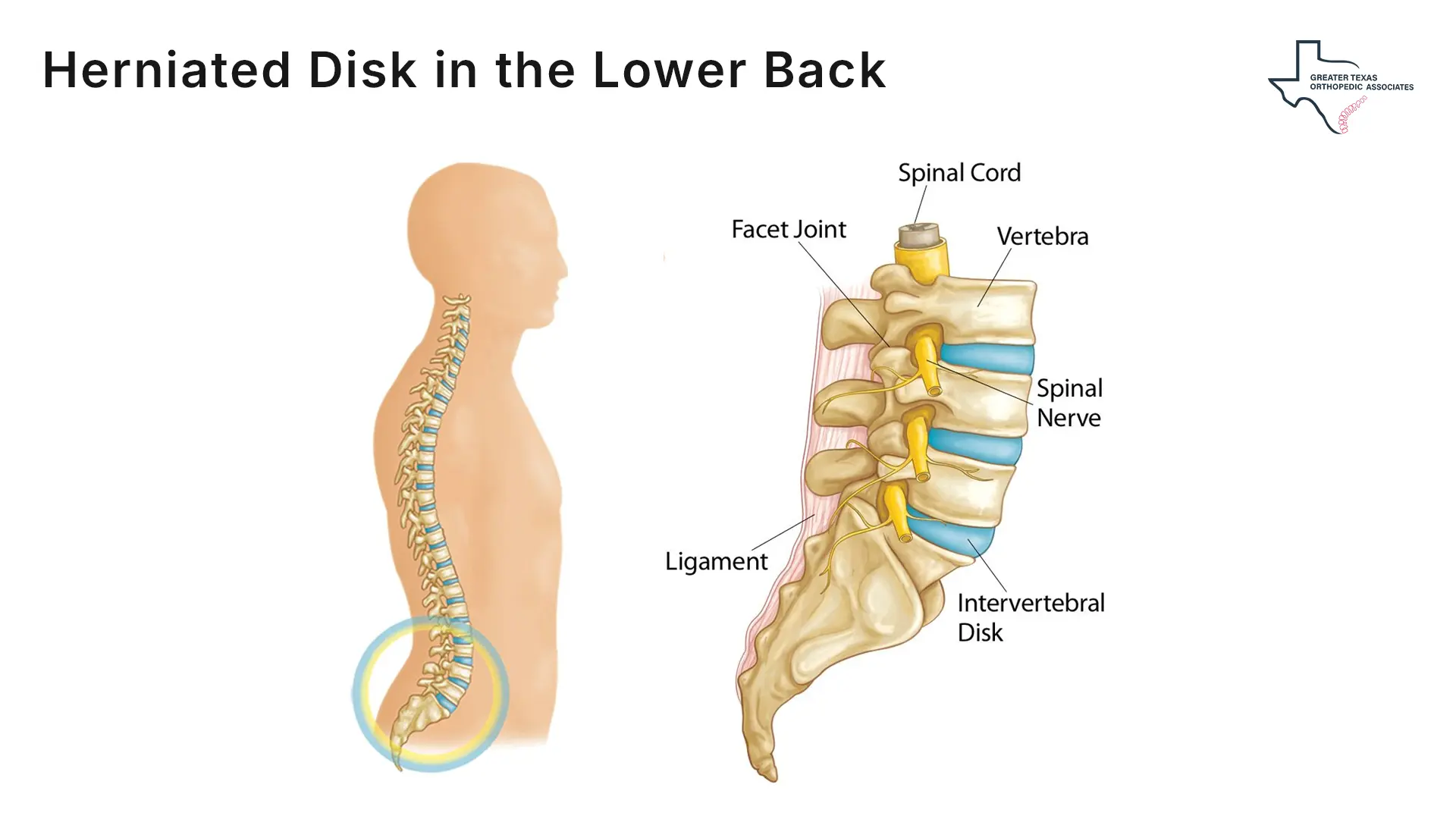 lower back disc symptoms