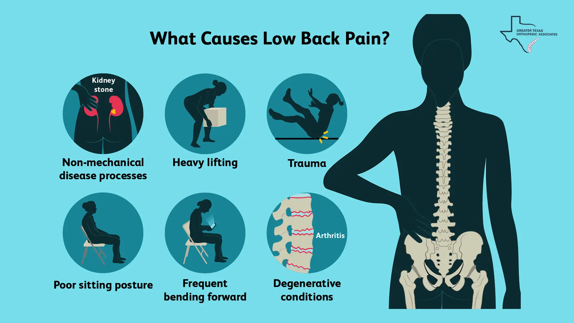 What Causes Back Pain?