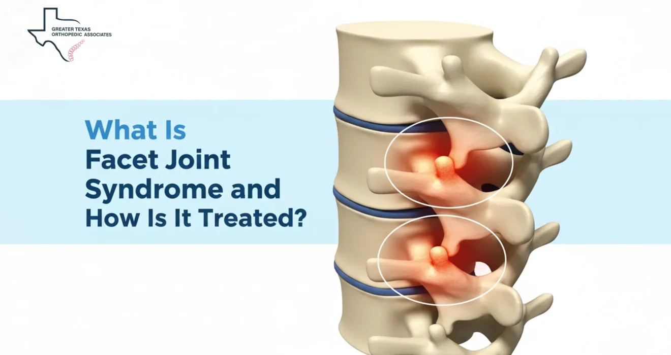 What Is Facet Joint Syndrome and How Is It Treated?
