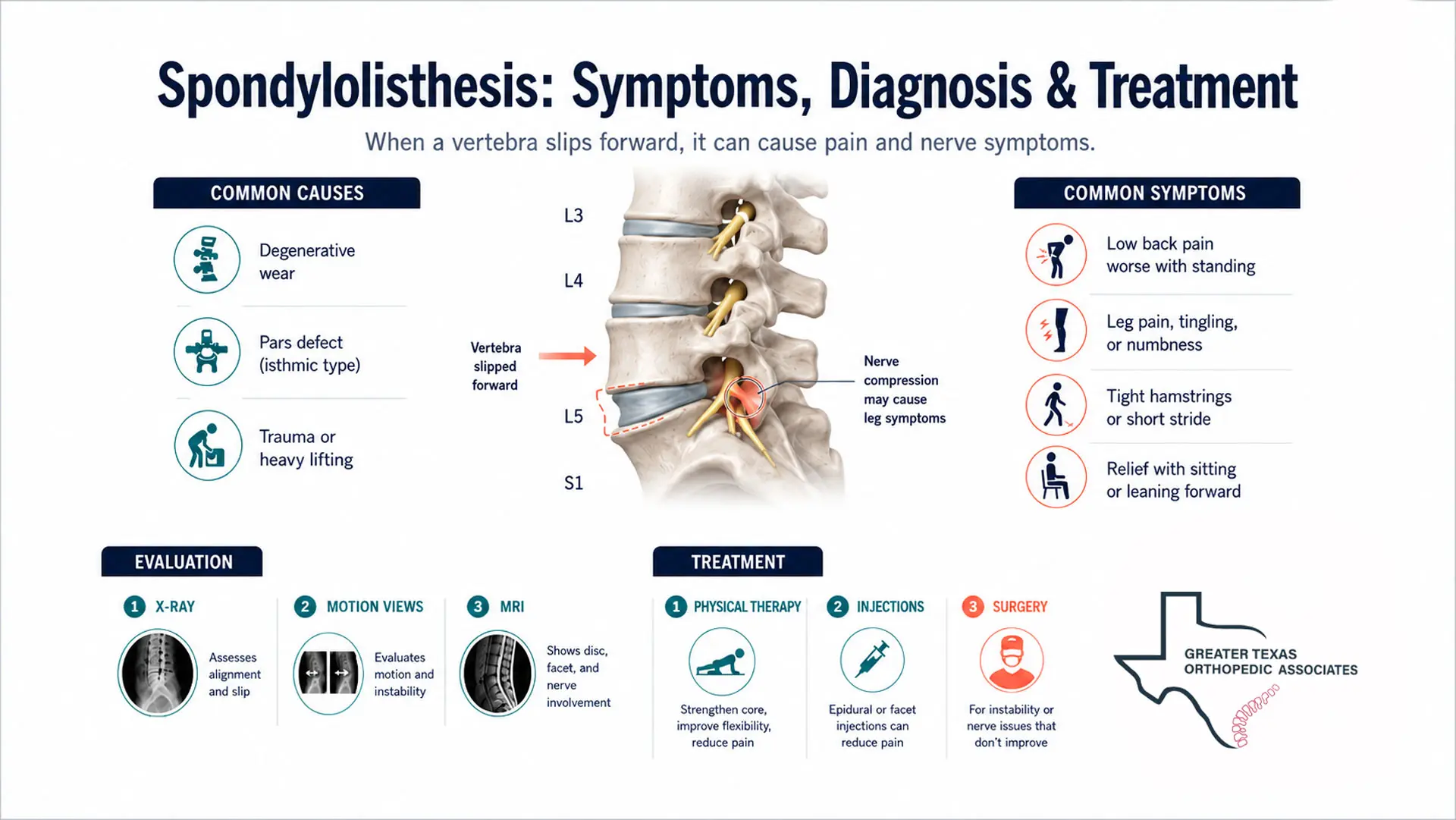 Infographic showing spondylolisthesis causes, symptoms, diagnostic imaging, and treatment options